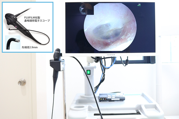 内視鏡｜耳鼻咽喉科さがわクリニック｜京都市西京区新林センター前にある耳鼻咽喉科